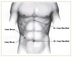 Slider image (3) Panama Gastric Surgery Center